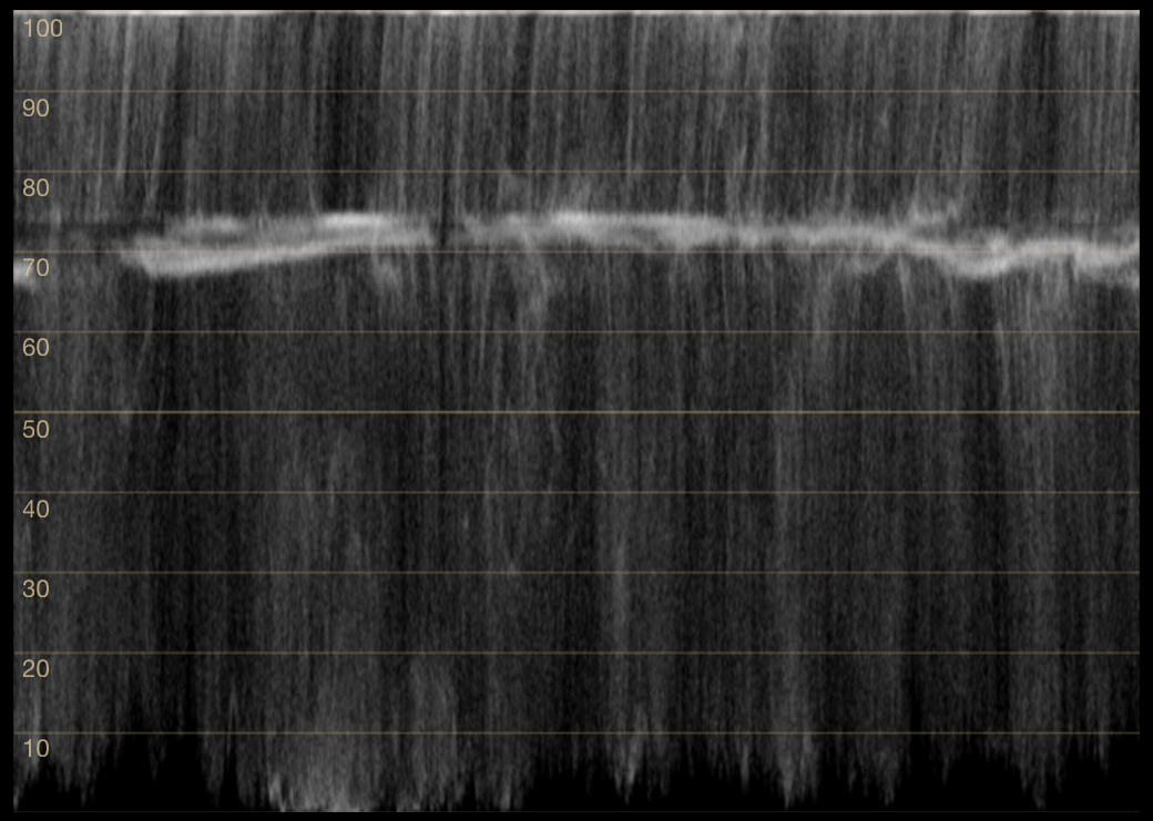 The same frame brightened until the top of the trace lies flat against the top of the scale instead of coming to a peak.